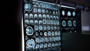Rahasia Puasa: Ubah Otak, Tingkatkan Kesehatan Mental Anda