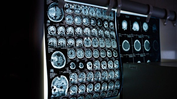 Rahasia Puasa: Ubah Otak, Tingkatkan Kesehatan Mental Anda